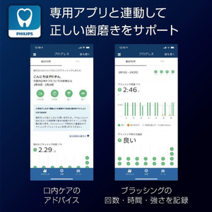 ソニッケア 電動歯ブラシ ダイヤモンドクリーン9000 ホワイト HX9911/57-イメージ8