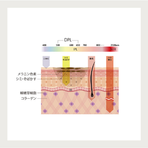 LINKA 光美容器(フェイス用) JC-L3808-イメージ9